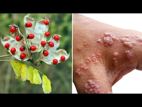11 Most Poisonous Plants in the World