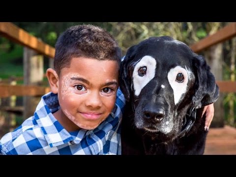 8-Year-Old Boy Embarrassed Of Vitiligo Meets Dog With Same Skin Condition