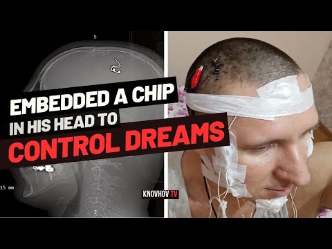 💉 Experiment Unleashed: Man Controls Lucid Dreams with Brain Chip!