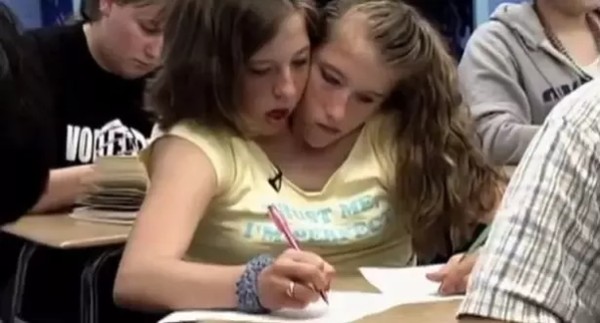 Abby and Brittany Hensel: How do Conjoined Twins take Exams? Did they each have their own grades and test scores?