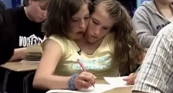 Knovhov TV on X: Abby and Brittany Hensel: Conjoined twins are very rare  in the world. Since they have two brains, they should be regarded as two  separate participants in examinations and