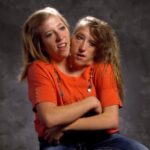 Abby and Brittany Hensel Now: Their Current Careers, Health, and Dating Life!
