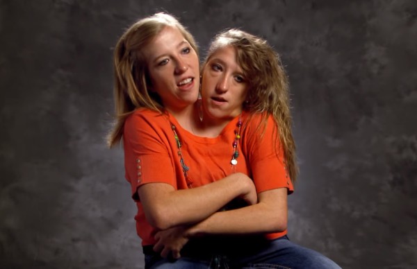 GodVine - Seeing conjoined twins Abby and Brittany now makes for one of  the best positive news stories out there! God created Abby and Brittany  Hensel so special. While these sisters share