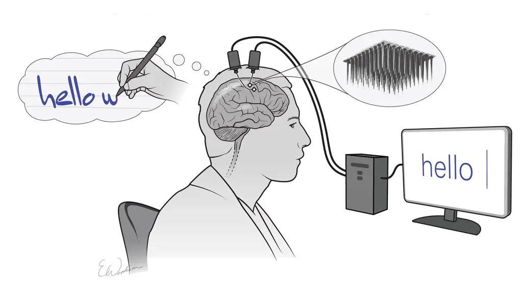 Brain to Text Communication: Visualized Letters of a Paralyzed Person into Text on a Screen