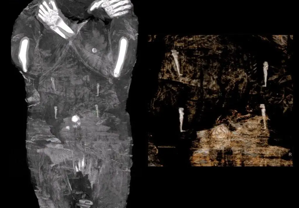 Body scans revealed a tiny foot in the mummy's pelvic section, confirming the mummy was a pregnant lady. It was the first time in the history of mummy research that a pregnant mummy was discovered and it is considered as the World’s First Pregnant Egyptian Mummy.