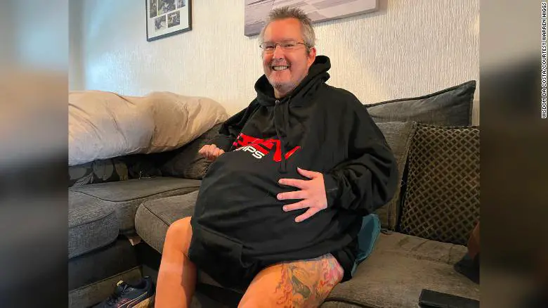 Warren Higgs, with Record-breaking Kidneys, Grew up to an Estimated 40kg due to Polycystic Kidney Disease