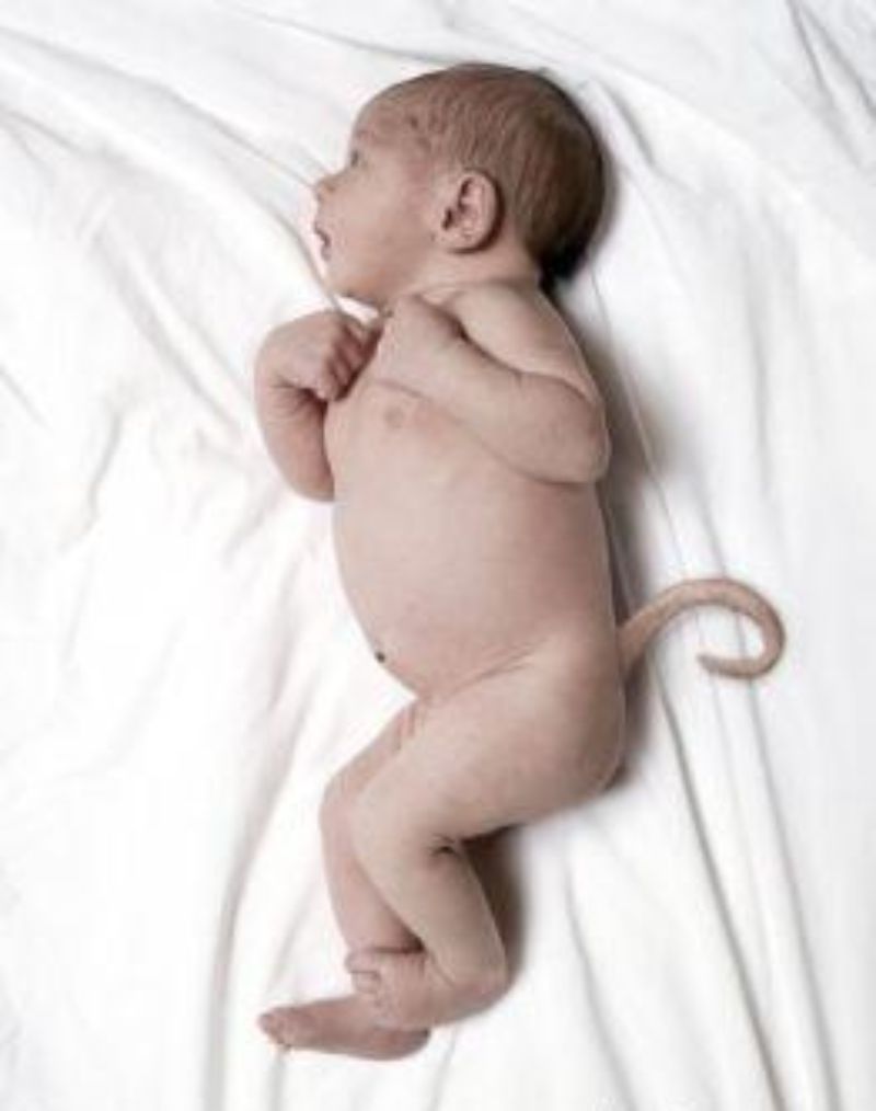 Babies that were Born with Real Tails