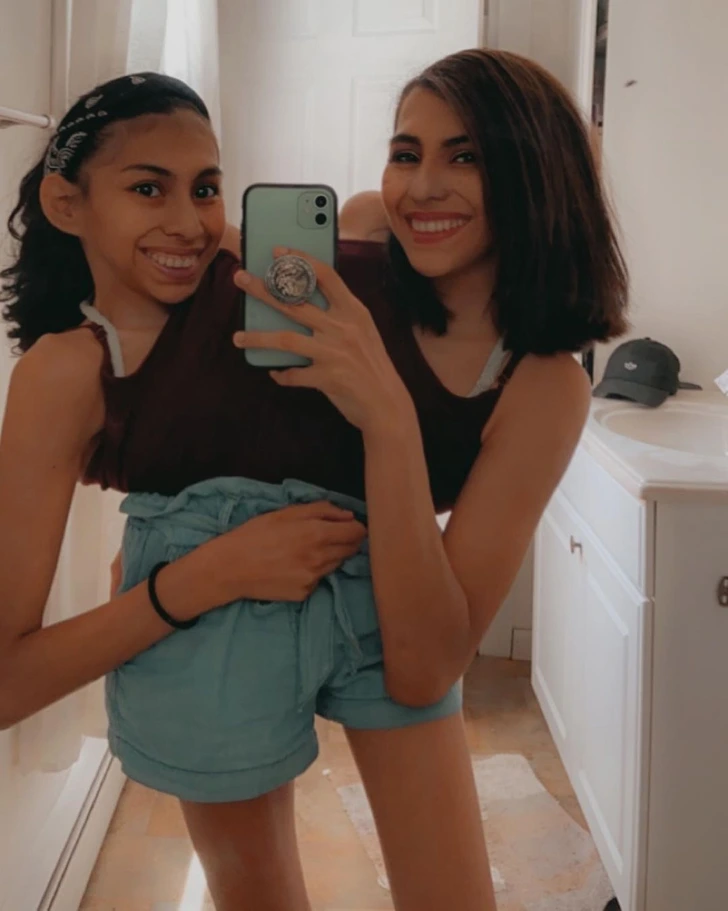 Conjoined Twins, but Only One of Us Has a Boyfriend: An Exclusive Interview with Conjoined Twins Lupita and Carmen