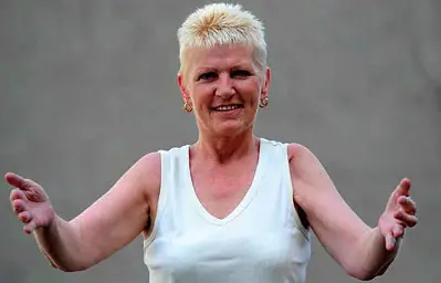 30 Most Extraordinary & Unbelievable People in the World Eileen Brown, dubbed the “Bionic Woman,” has had nearly all her major joints replaced due to rheumatoid arthritis. Born in 1959 in Boldon Colliery, UK, she began experiencing symptoms in her 20s.