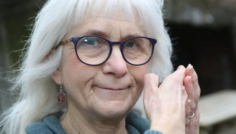 30 Most Extraordinary & Unbelievable People in the World Jo Cameron, born around 1948 in Scotland, UK, discovered at age 65 that she cannot feel pain due to a rare genetic mutation affecting the FAAH gene, which regulates pain and mood.