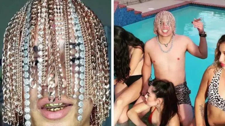 Mexican Rapper Implants Gold Chains into his Scalp, Becomes the First to Do So