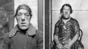 Mary Ann Bevan, dubbed ugliest woman, joined circus to feed kids after acromegaly struck. Her tragic circus story shines as a mother’s sacrifice.