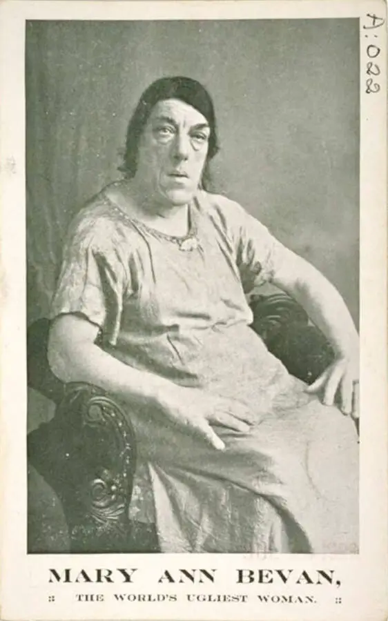 Explore the compelling life of Mary Ann Bevan, the 'Ugliest Woman in the World,' in this tragic and inspiring story. Uncover her extraordinary journey of courage and resilience.