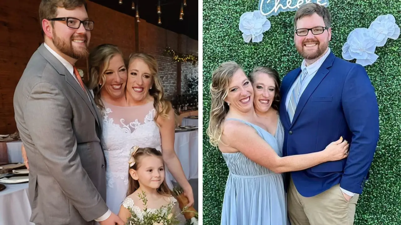 Abby Hensel is Married! Secretly Get Married to an Army Veteran in 2021