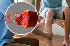 The Path to Healthier Legs: Exploring Vein Treatment Options