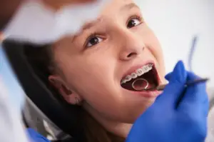 Living with braces is a journey that requires patience, diligence, and a bit of adjustment. While the end result—a straighter, healthier smile—is well worth the effort, the experience of wearing braces can pose several challenges and demands a proactive approach to oral hygiene, diet, and overall care. Here’s a comprehensive guide to help you navigate life with braces.