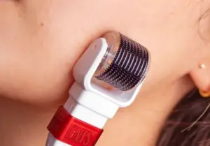 Have you been searching for a way to rejuvenate your skin? Are you curious about a simple yet effective tool that could transform your skincare routine? The Skin-Inject Microneedling Roller is a game-changer in the beauty industry, offering many benefits that can help you achieve healthier, glowing skin. This article explores the top four benefits of using the Mirco needling roller and how it can enhance your skincare routine.