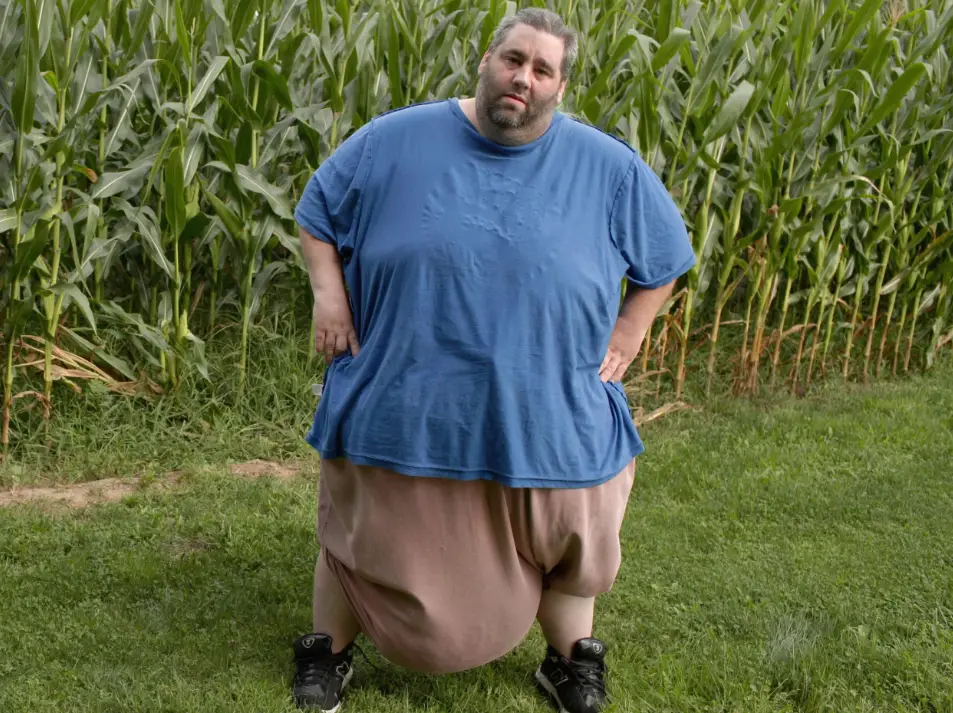 Discover Wesley Warren Jr.'s battle with a 132-pound scrotum due to rare scrotal lymphedema. Learn about his 13-hour surgery, recovery, and the global impact of this medical anomaly.