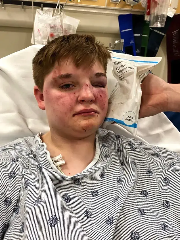 Brutal attack on lesbian woman in Illinois ‘Just because I walked into the woman’s bathroom’ sparks hate crime investigation A brutal attack on Kady Grass, a 19-year-old lesbian woman, at a McDonald's in Carpentersville, Illinois, on May 13, 2025, has shocked the community and drawn national attention.