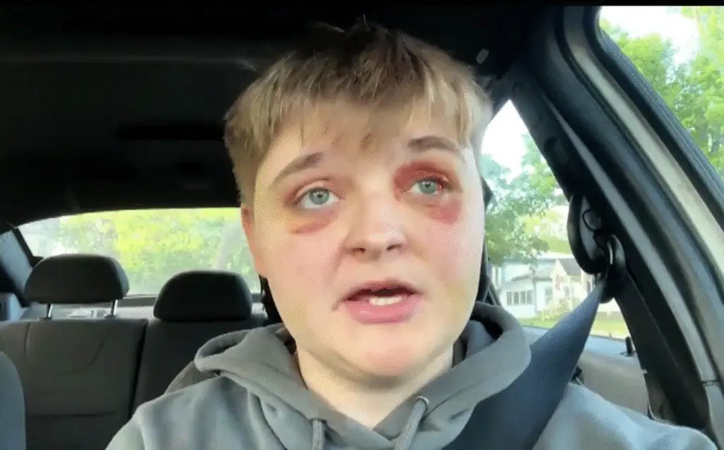 Brutal attack on lesbian woman in Illinois ‘Just because I walked into the woman’s bathroom’ sparks hate crime investigation A brutal attack on Kady Grass, a 19-year-old lesbian woman, at a McDonald's in Carpentersville, Illinois, on May 13, 2025, has shocked the community and drawn national attention.