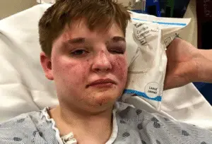A brutal attack on Kady Grass, a 19-year-old lesbian woman, at a McDonald's in Carpentersville, Illinois, on May 13, 2025, has shocked the community and drawn national attention.