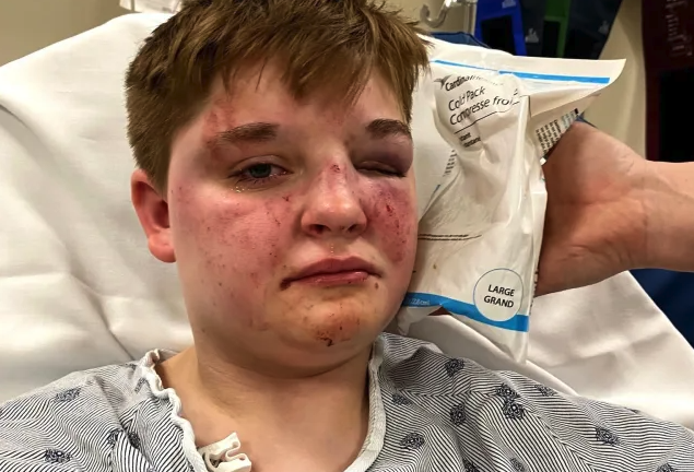 Brutal attack on lesbian woman in Illinois ‘Just because I walked into the woman’s bathroom’ sparks hate crime investigation