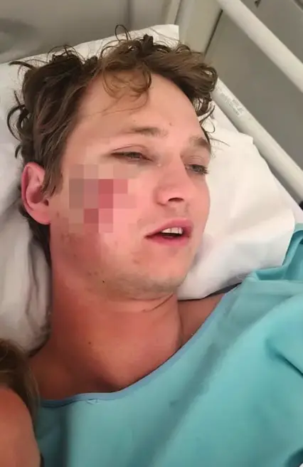 27-year-old mauled by ferocious hyenas after being dragged from tent while sleeping off booze at Cape Vidal. Shocking wildlife attack leaves farmer with 70 stitches. Read the harrowing tale.