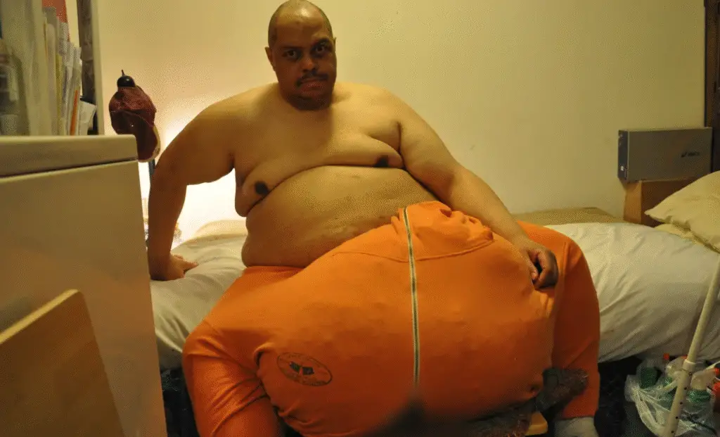 Discover Wesley Warren Jr.'s battle with a 132-pound scrotum due to rare scrotal lymphedema. Learn about his 13-hour surgery, recovery, and the global impact of this medical anomaly.