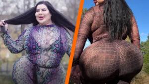 Over 38 million cosmetic procedures occurred worldwide in 2024, a 42.5% rise from four years earlier, yet few stories capture attention like that of a Serbian glamour model pursuing the ultimate in body enhancement.