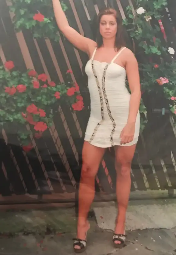 Over 38 million cosmetic procedures occurred worldwide in 2024, a 42.5% rise from four years earlier, yet few stories capture attention like that of a Serbian glamour model pursuing the ultimate in body enhancement.