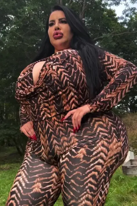 Over 38 million cosmetic procedures occurred worldwide in 2024, a 42.5% rise from four years earlier, yet few stories capture attention like that of a Serbian glamour model pursuing the ultimate in body enhancement.